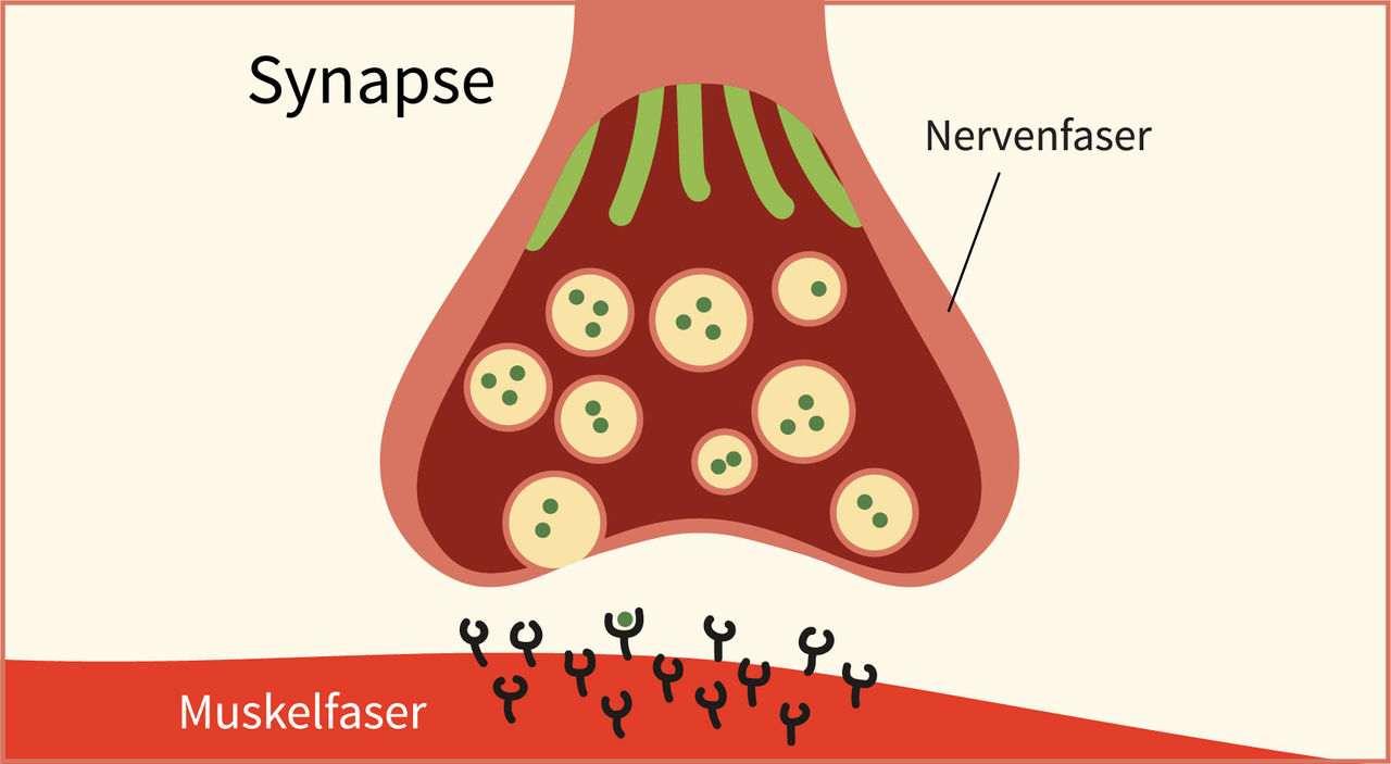 Beides im Bild also Muskel und Nerv bildet die Synapse, der Strich beiSynapse müsste also entfernt werden